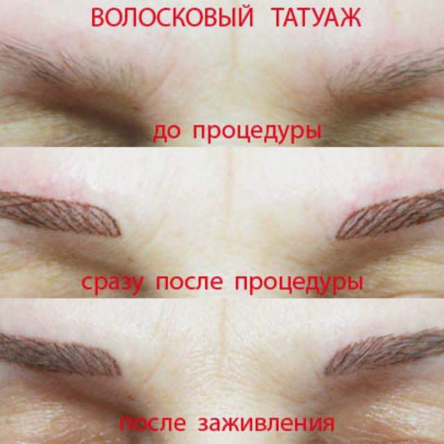 Плюсы волосковой техники Плюсы волосковой техники